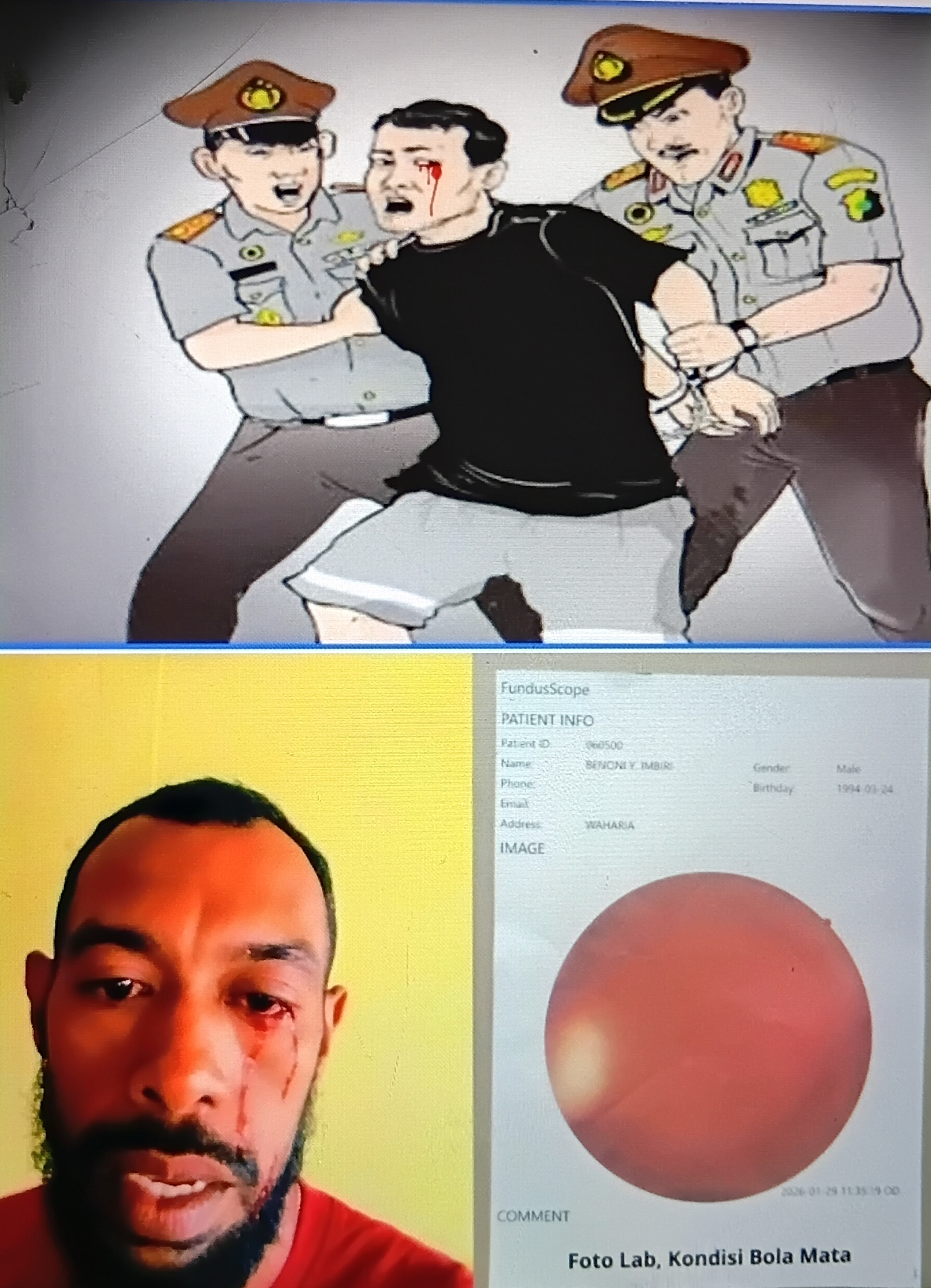 LSM LIRA Papua: Mental Dendam Aparat Polres Waropen Harus Ditindak Tegas